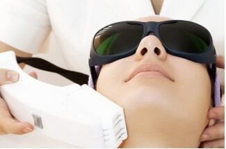 procedure