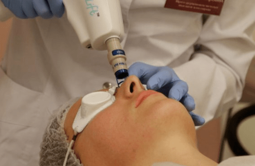 Non -able laser rejuvenation